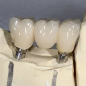 зуботехническая лаборатория profitdent изображение 4 на проекте moeizmailovo.ru