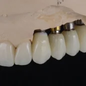 зуботехническая лаборатория profitdent изображение 5 на проекте moeizmailovo.ru